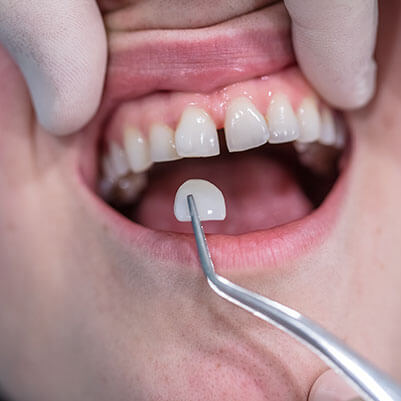 Orthodontic Treatment Glenroy
